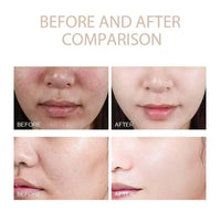 Dr Melaxin Rice Ampoule Gentle Exfoliant Exfoliating Essence Moisturizing Glow Korean Skincare All Skin Types Face Treatment